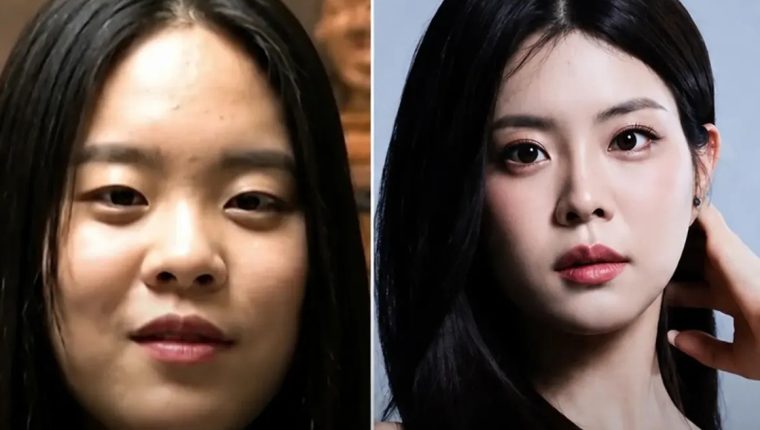 Tân hoa hậu Hàn Quốc vướng ồn ào phẫu