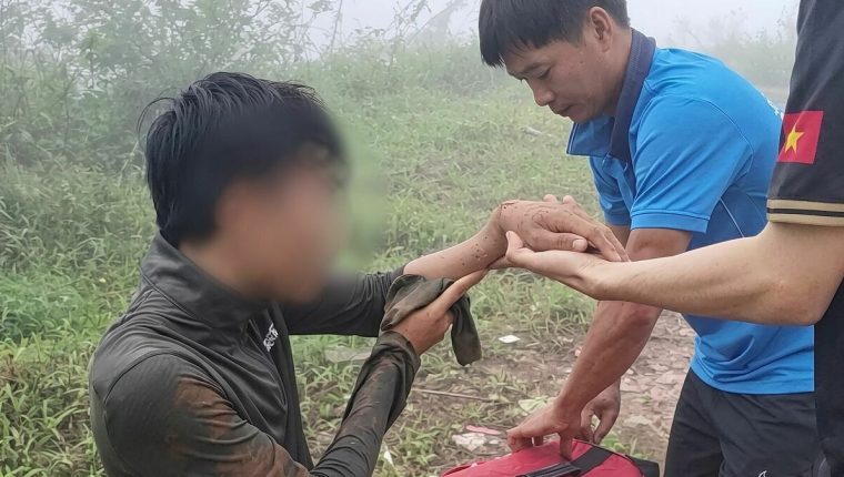 Du khách trượt ngã, gãy tay khi leo núi